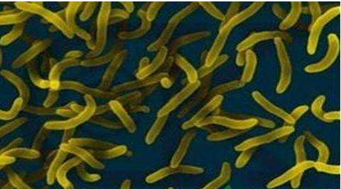 微生物菌劑好？好在哪里您知道嗎？